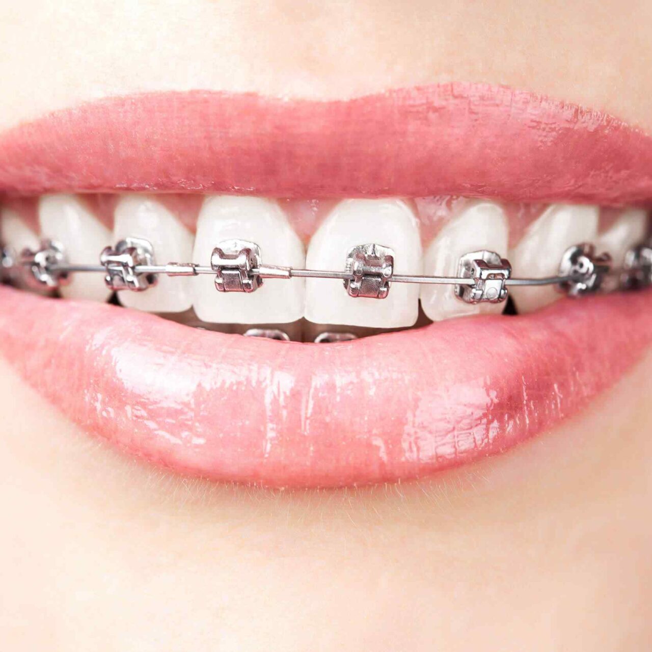 https://dentwell.mx/wp-content/uploads/2020/01/post-03-1280x1280.jpg