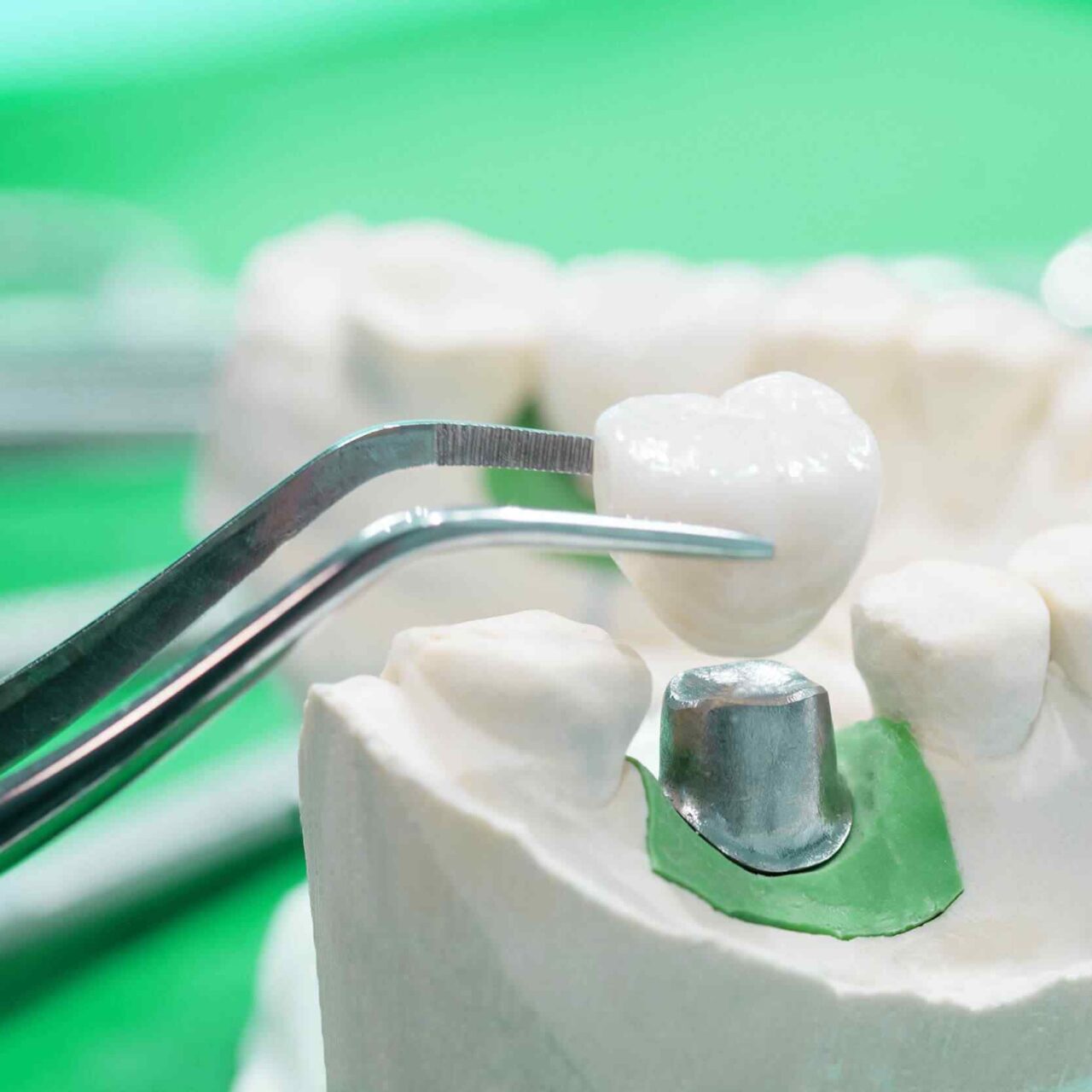 https://dentwell.mx/wp-content/uploads/2020/01/post-28-1280x1280.jpg