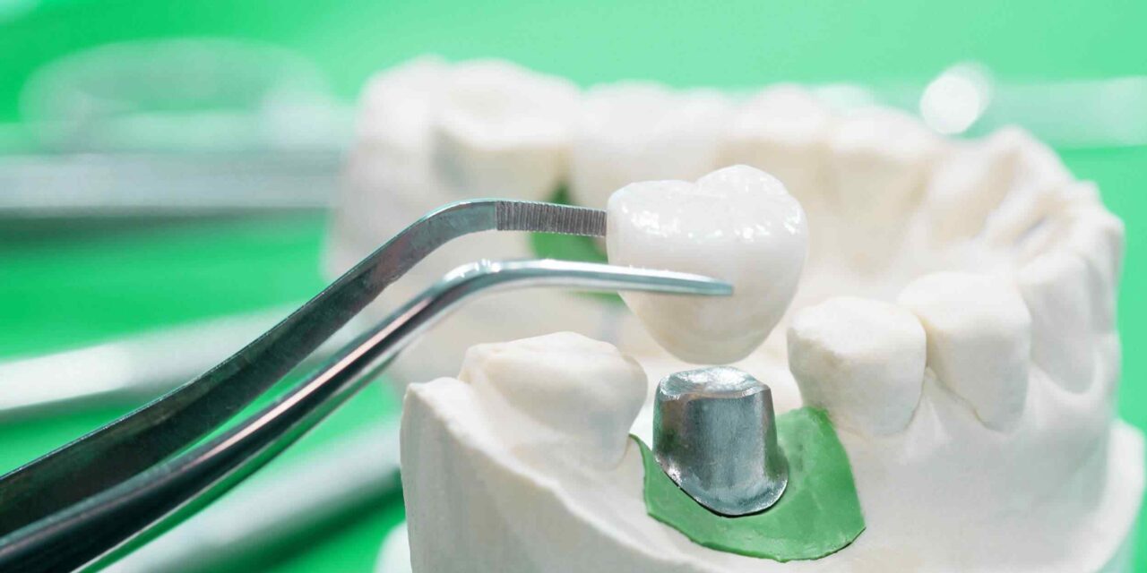 https://dentwell.mx/wp-content/uploads/2020/01/post-28-1280x640.jpg